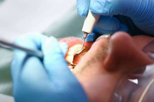 Best Teeth Whitening  in Coldwater, OH