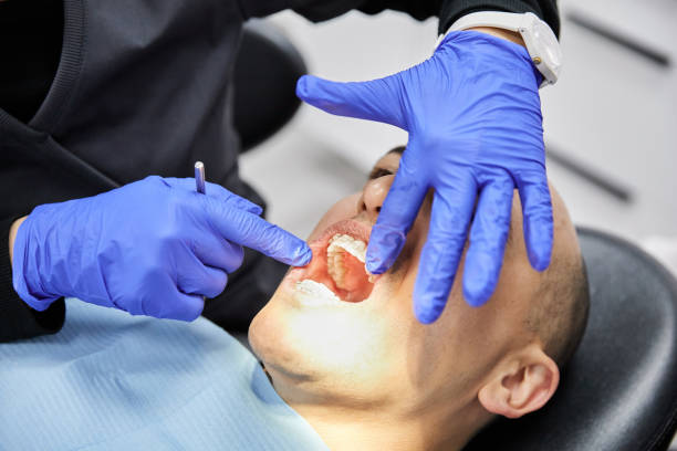 Best Broken Tooth Emergency  in Coldwater, OH